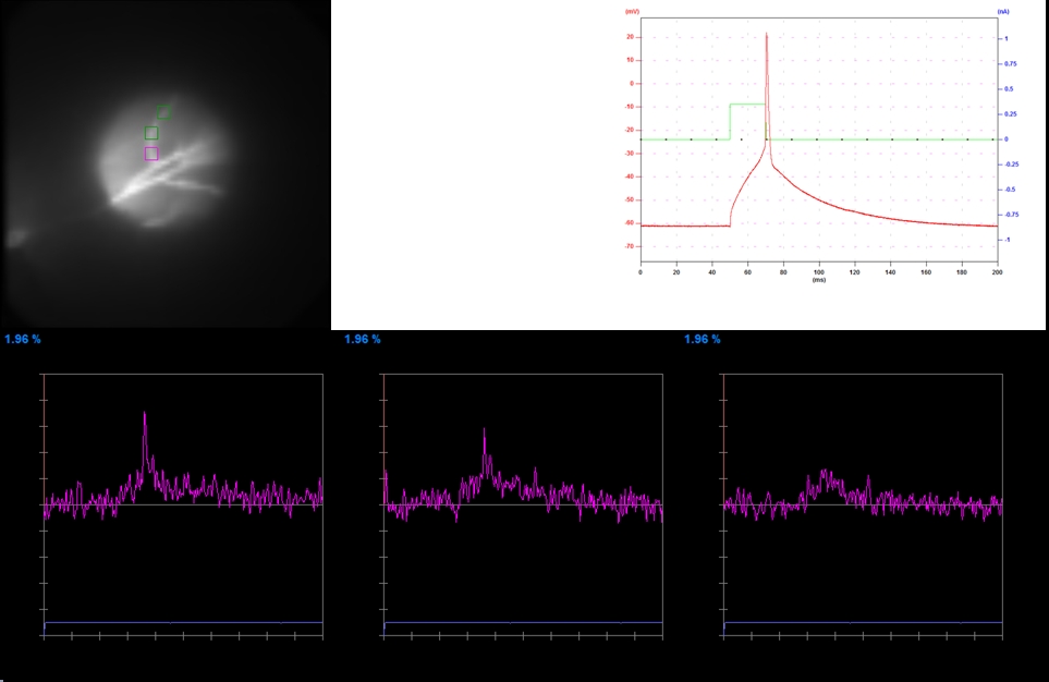 Voltage Imaging on Obliques