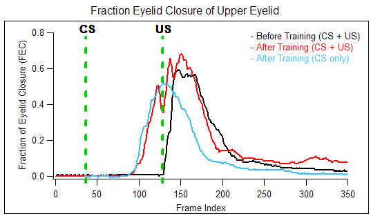 Fraction Eyelid Closure of Upper Eyelid