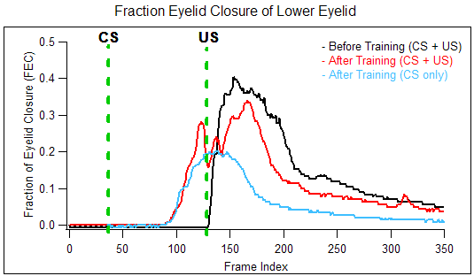 Fraction Eyelid Closure of Lower Eyelid